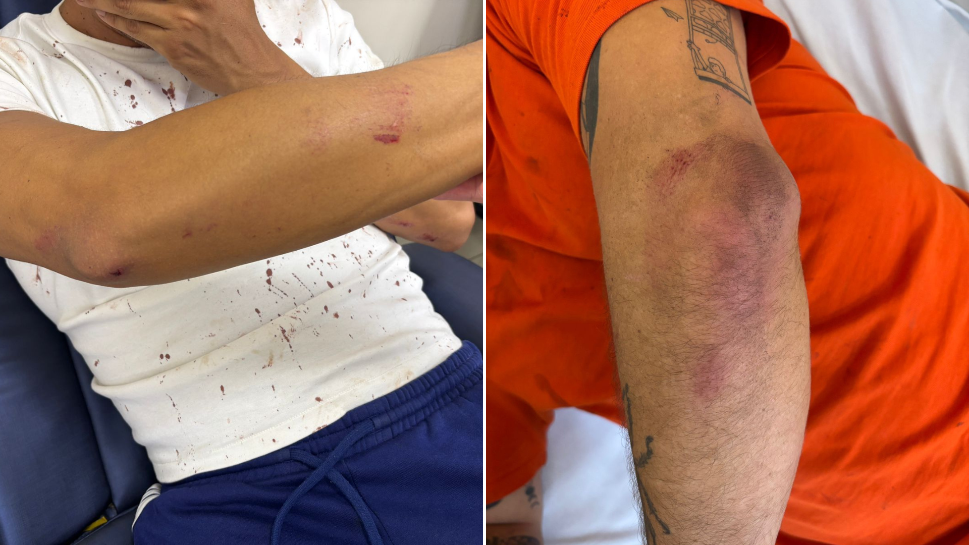 Ataques homofóbicos em SP ficam sem identificação de autores e vítimas relatam frustração episode artwork