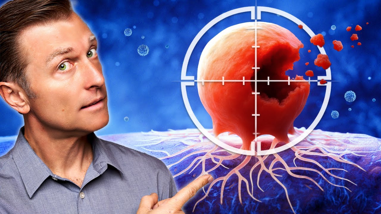 How to Never Get Cancer (30 Scientifically Proven Tips)